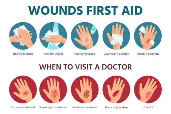 First Aid for Wound on Skin: Essential Treatment and Practical Guidance